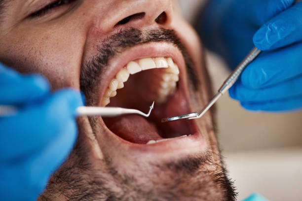 Best Walk-In Emergency Dental Services in Maumelle, AR