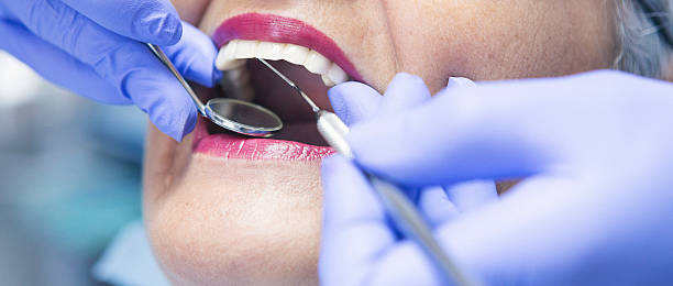 Best Emergency Wisdom Tooth Extraction in Maumelle, AR